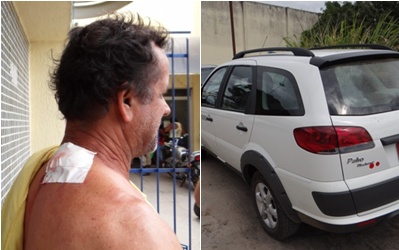 Aldo Matos/Acorda Cidade | Taxista ferido foi atendido numa policlínica