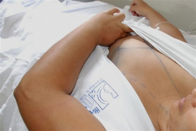 Hospital da Mulher realiza triagem para cirurgia das mamas gigantes