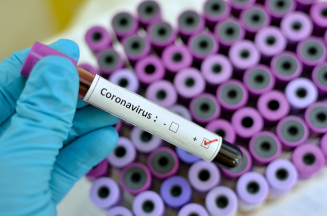 Diagnosticado em uma mulher, de 50 anos, quinto caso de coronavírus em Feira