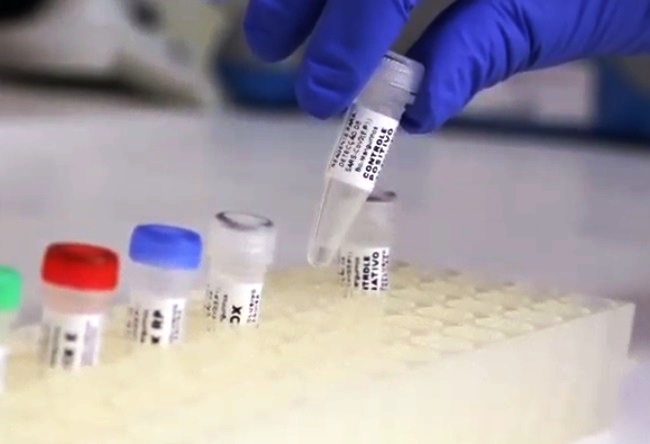 Feira registra  63 casos positivos de Covid-19 em exames coletados em um mês